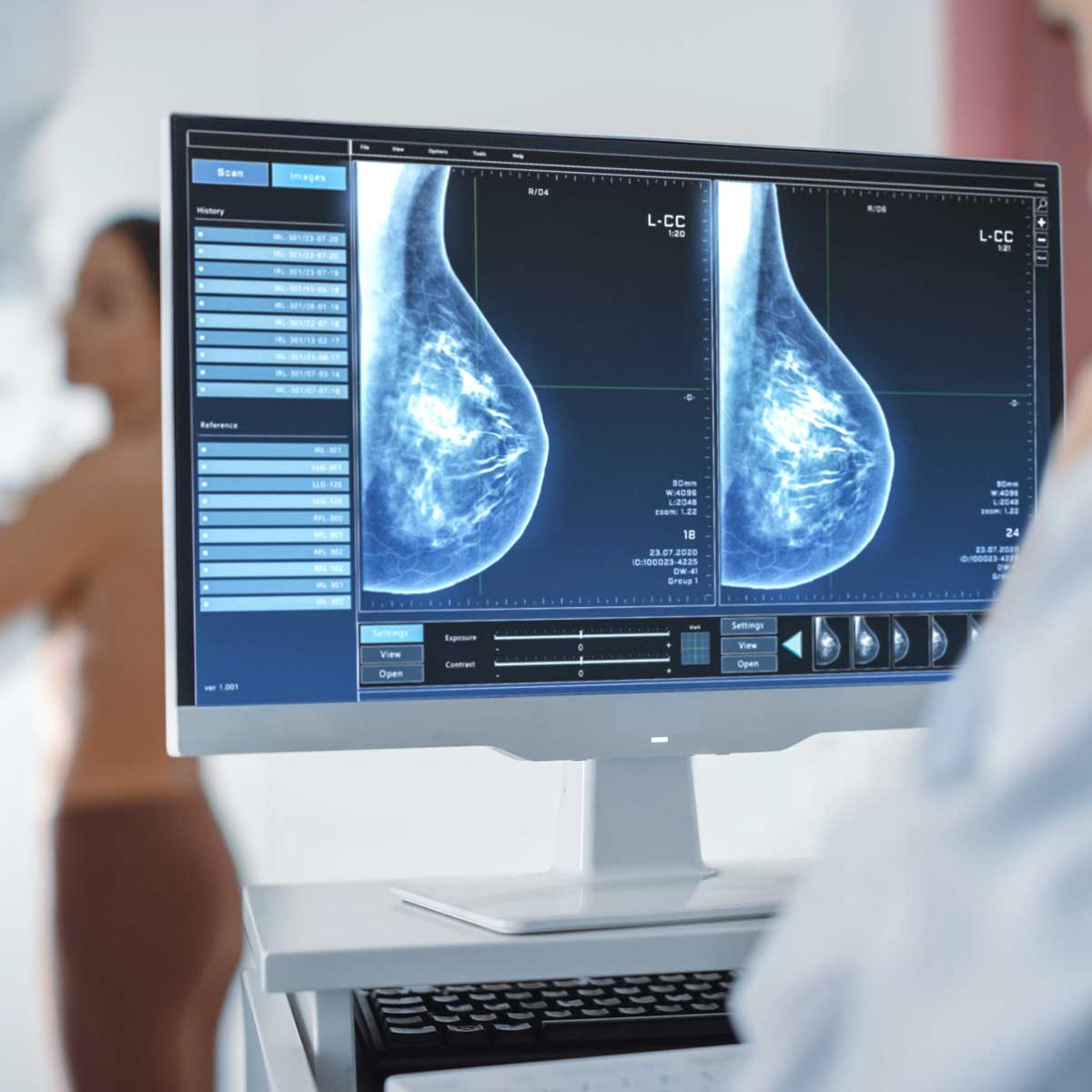 Isabell Digital Tomosynthesis Mammography System