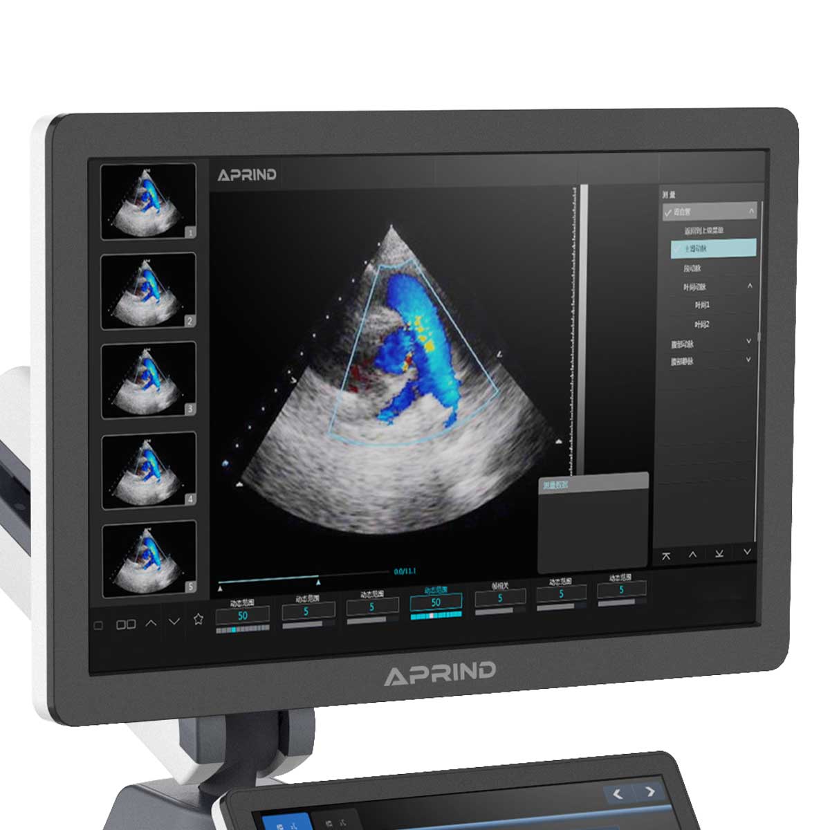spirit60 Full Digital Color Doppler Ultrasonic Diagnostic System